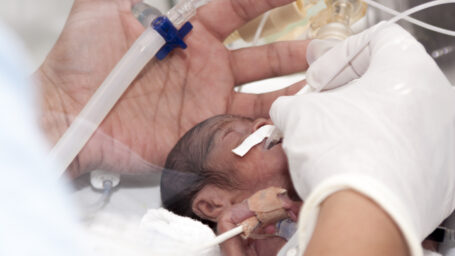 Portrait of newborn baby and hand inside incubator