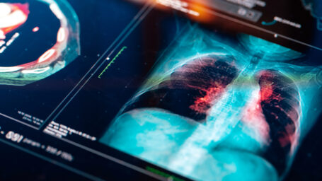 Diagnostic scan of a patient's lungs