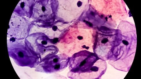 Microscopic view of Paps smear, 100x. Medical or health concept. cytology or histology