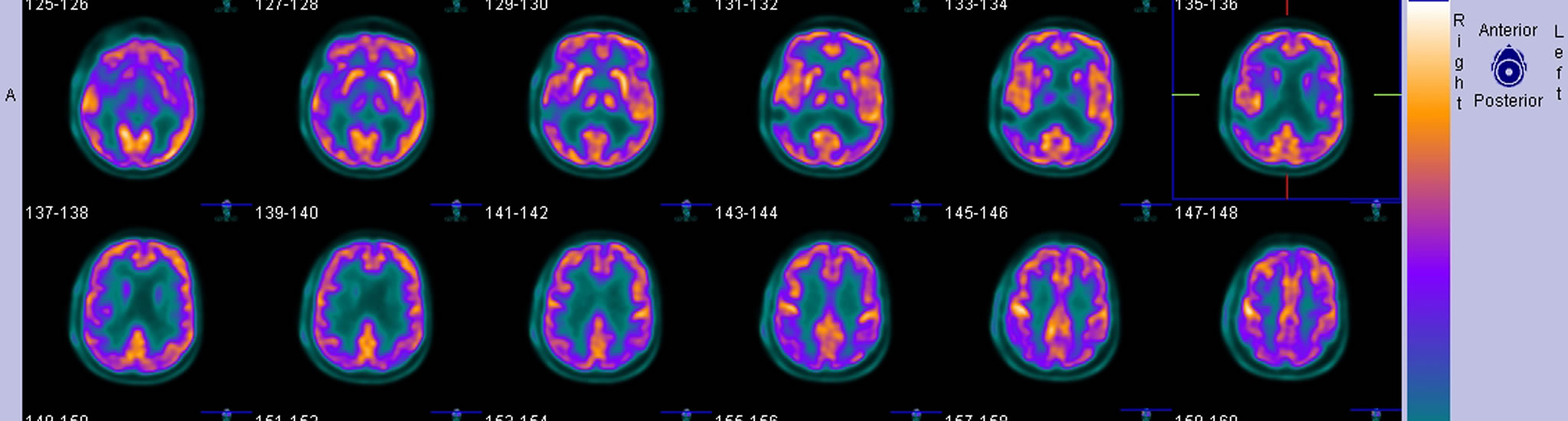 Nuclear Medicine Imaging Sciences | College of Health Professions